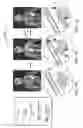 Fig. 02 - REFILLABLE DRUG DELIVERY DEVICES AND METHODS OF USE THEREOF