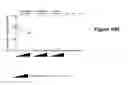 Fig. 44 - Liver-specific constructs, factor VIII expression cassettes and methods of use thereof