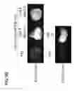 Fig. 13 - Targeted Therapeutics