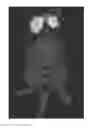 Fig. 01 - Fluorescent imaging agents