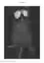 Fig. 02 - Fluorescent imaging agents