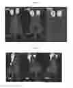 Fig. 04 - Fluorescent imaging agents