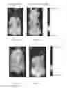 Fig. 11 - Fluorescent imaging agents