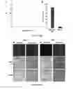 Fig. 06 - Enzymatically responsive magnetic particles and their use
