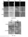 Fig. 07 - Enzymatically responsive magnetic particles and their use