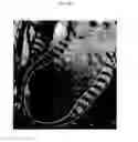 Fig. 40 - Methods and compositions for stabilizing the myocardium