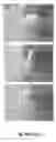 Fig. 05 - COMPOSITIONS AND METHODS FOR REPAIRING BONE