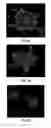 Fig. 06 - Electrospun electroactive polymers for regenerative medicine applications