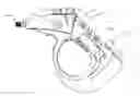 Fig. 01 - Powered lavage handle and associated use therefore
