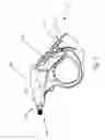 Fig. 06 - Powered lavage handle and associated use therefore