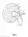 Fig. 09 - Hands-free breast pump adapter system