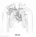 Fig. 02 - Devices, methods and systems for establishing supplemental blood flow in the circulatory system