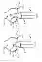 Fig. 06 - Pump for implantation into a vessel