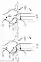 Fig. 07 - Pump for implantation into a vessel