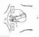 Fig. 08 - Pump for implantation into a vessel