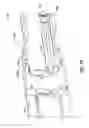Fig. 11 - Multiaxial connector for implantable devices