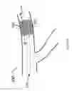 Fig. 02 - Systems and methods for providing zones of selective thermal therapy