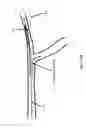Fig. 05 - Systems and methods for providing zones of selective thermal therapy
