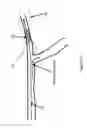 Fig. 06 - Systems and methods for providing zones of selective thermal therapy