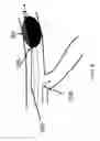 Fig. 08 - Systems and methods for providing zones of selective thermal therapy