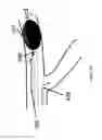 Fig. 10 - Systems and methods for providing zones of selective thermal therapy