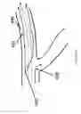 Fig. 11 - Systems and methods for providing zones of selective thermal therapy