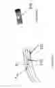 Fig. 13 - Systems and methods for providing zones of selective thermal therapy