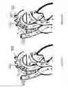 Fig. 18 - Systems and methods for providing zones of selective thermal therapy