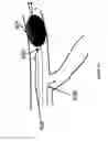 Fig. 10 - Systems and methods for flow stagnation control