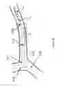 Fig. 17 - Systems and methods for flow stagnation control