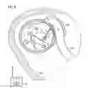 Fig. 07 - Implantable infusion devices and methods