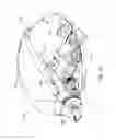 Fig. 15 - Flow regulating inhaler device