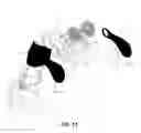 Fig. 09 - STRAPLESS NASAL INTERFACE DEVICE