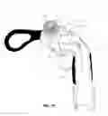 Fig. 16 - STRAPLESS NASAL INTERFACE DEVICE