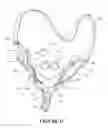 Fig. 02 - Patient interface and aspects thereof