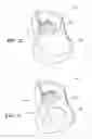 Fig. 40 - Patient interface and aspects thereof