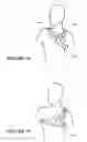 Fig. 48 - Patient interface and aspects thereof