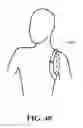 Fig. 49 - Patient interface and aspects thereof