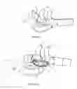 Fig. 03 - Breathing assistance apparatus