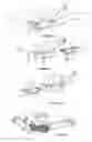 Fig. 04 - Breathing assistance apparatus