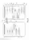 Fig. 10 - REMOTE CONTROL SYSTEM AND METHOD FOR USE IN INTRALUMINALLY OR INTRAVASCULARLY LOCATED OPERATIONS