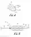 Fig. 03 - Anchor device for use with catheters