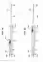 Fig. 23 - Medical device and method for treatment of a sinus opening