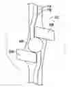 Fig. 01 - Fluid infusion systems and methods