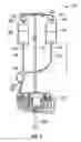 Fig. 03 - Fluid infusion systems and methods