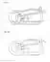 Fig. 04 - Clamp device for flexible tube