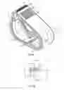 Fig. 04 - Pinch clamp device