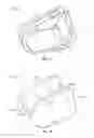 Fig. 11 - Pinch clamp device