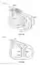 Fig. 18 - Pinch clamp device