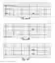 Fig. 11 - Detection of implantable lead failures by differential EGM analysis
